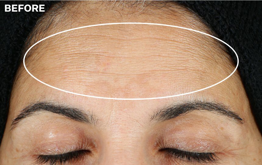 Super-C-Retinol_Serum_Visible_Results_ before