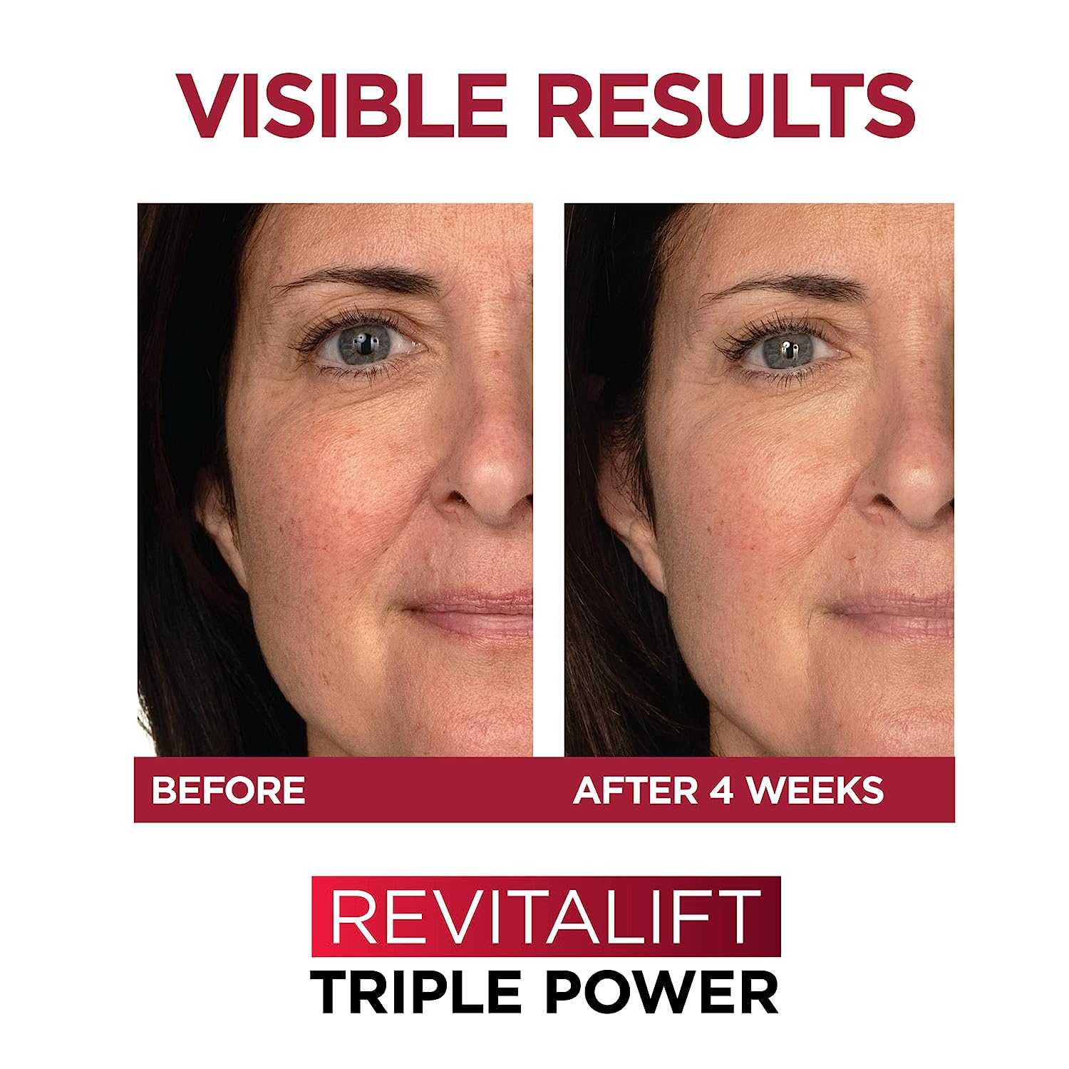 Revitalift Triple Power Anti-Aging Face Moisturizer, Pro Retinol, Hyaluronic Acid & Vitamin C, Reduce Wrinkles 2.55 Oz - EXprimi Skincare Kenya - Beauty - L'Oreal Paris - EXprimi Skincare Kenya.